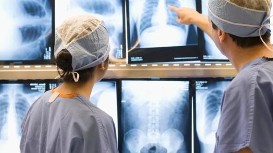 two medical students examining xrays